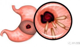 幽门螺旋杆菌最新爆料,揭秘胃病元凶的神秘面纱